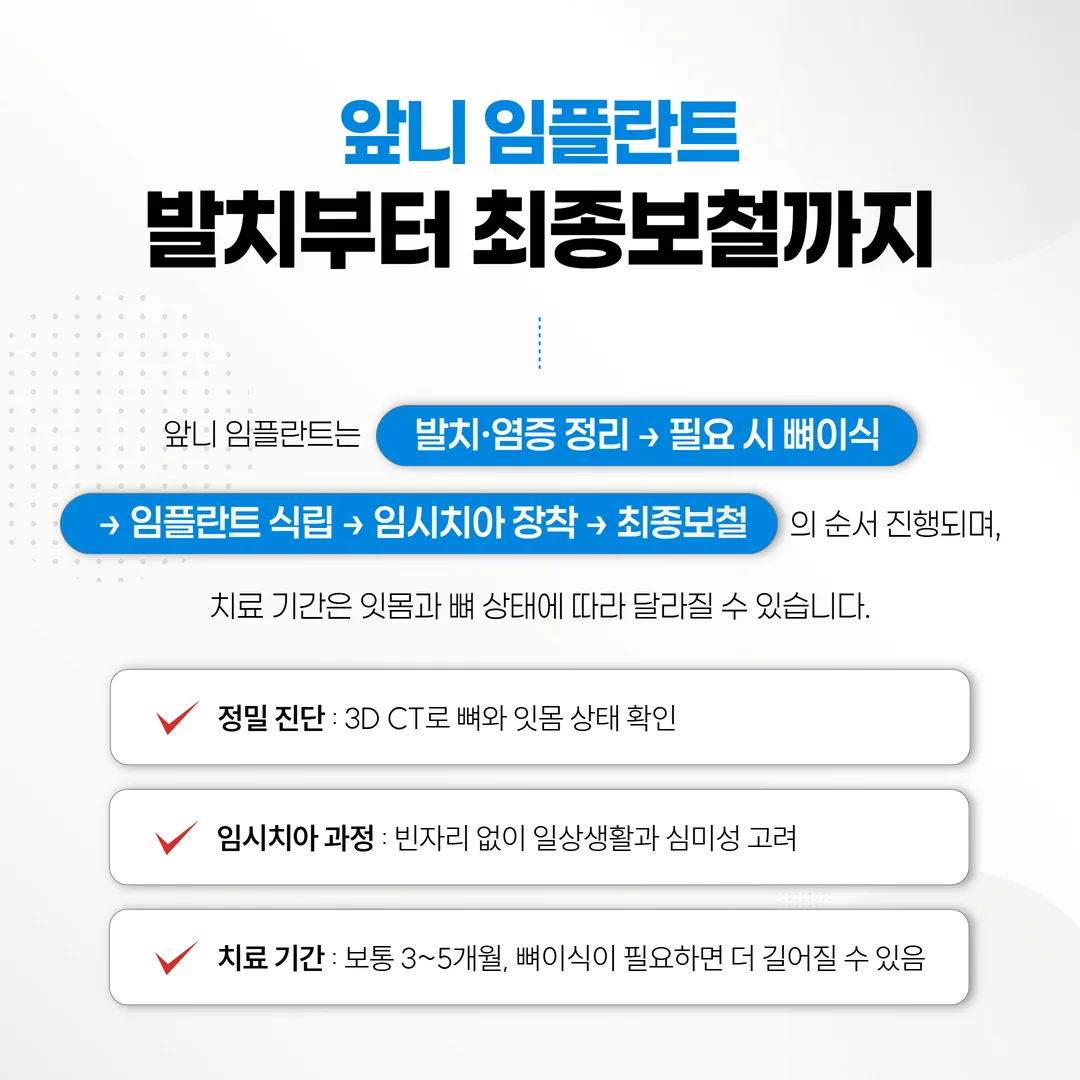 앞니 임플란트 치료 단계별 과정도