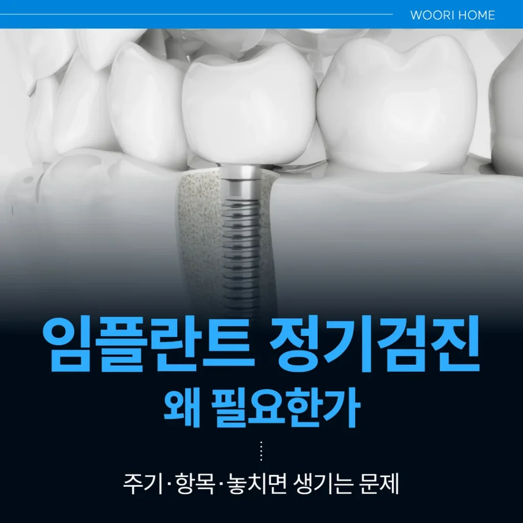 임플란트 정기검진, 왜 필요한가 — 주기·항목·놓치면 생기는 문제 (울산 남구)