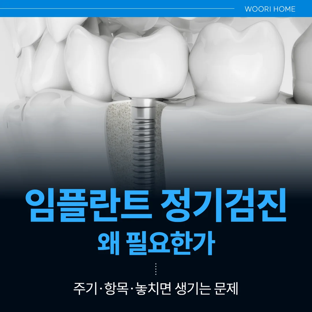 임플란트 정기검진, 왜 필요한가 — 주기·항목·놓치면 생기는 문제 (울산 남구)