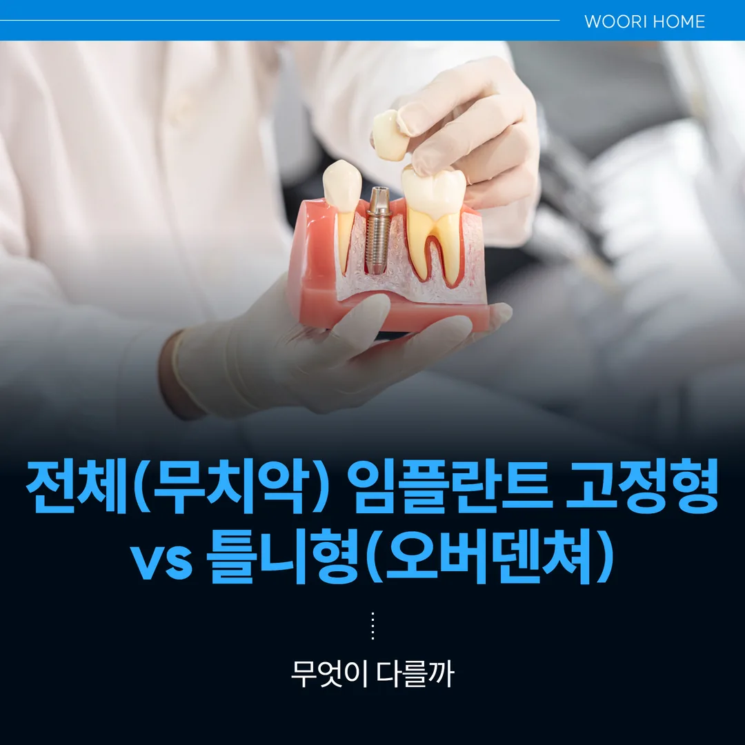 전체(무치악) 임플란트 고정형 vs 틀니형(오버덴쳐), 무엇이 다를까 — 울산 남구 우리홈치과의원