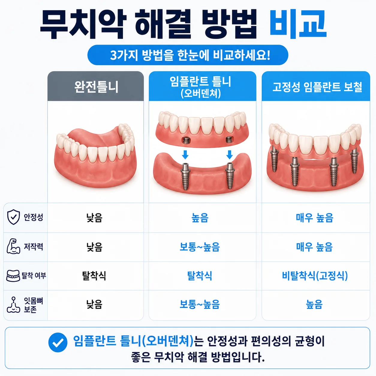 울산 남구 무치악 임플란트 해결 옵션 비교