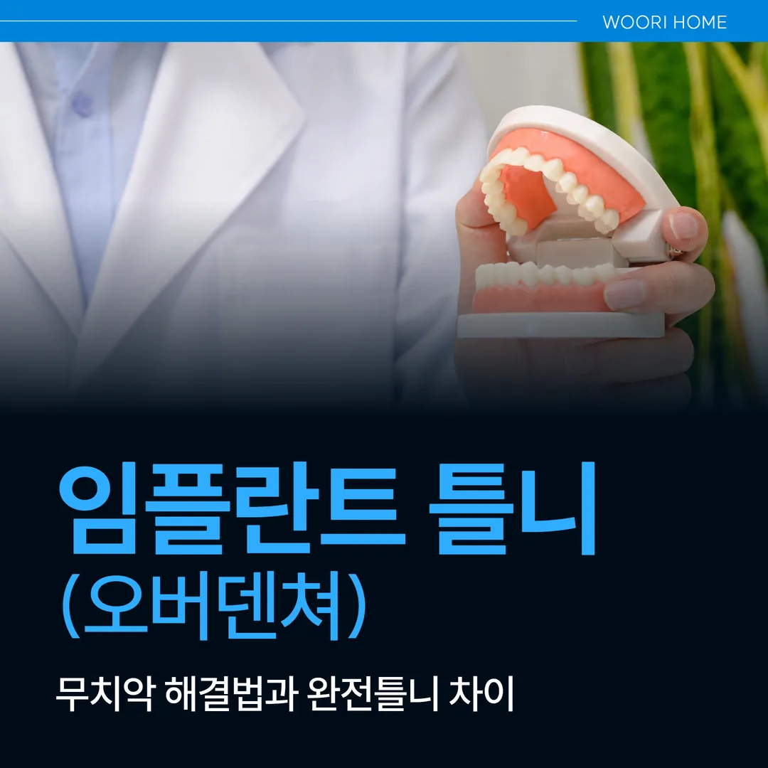 울산 남구 임플란트 틀니(오버덴쳐), 무치악 해결법과 완전틀니 차이
