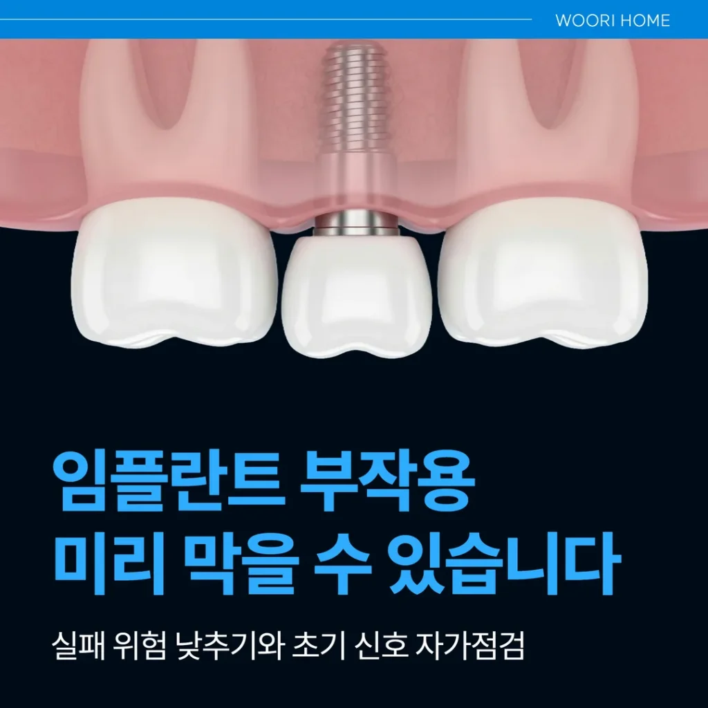 임플란트 부작용, 미리 막을 수 있습니다 — 실패 위험 낮추기와 초기 신호 자가점검 (울산 남구)
