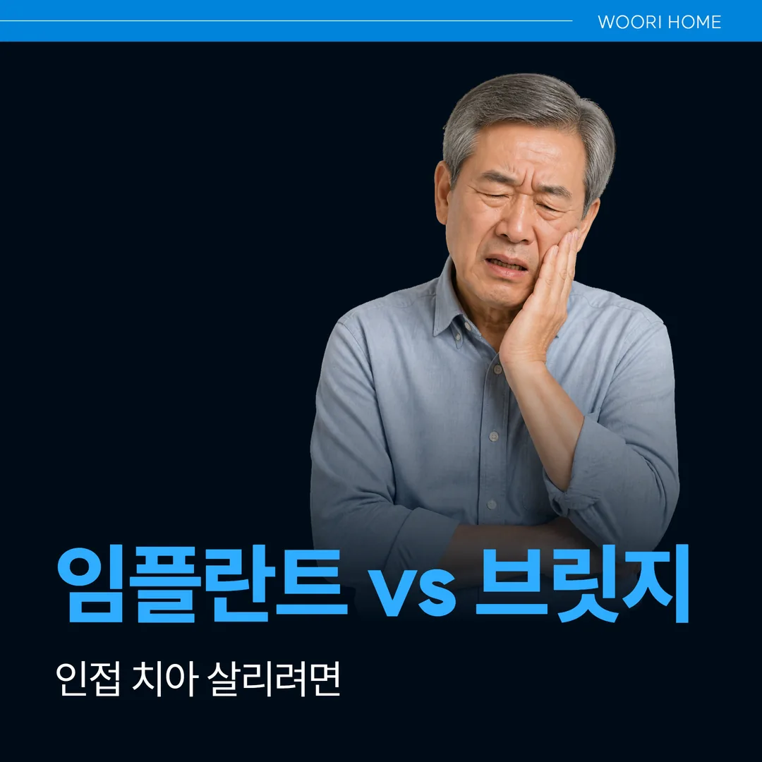 임플란트 vs 브릿지, 인접 치아 살리려면(울산 남구)