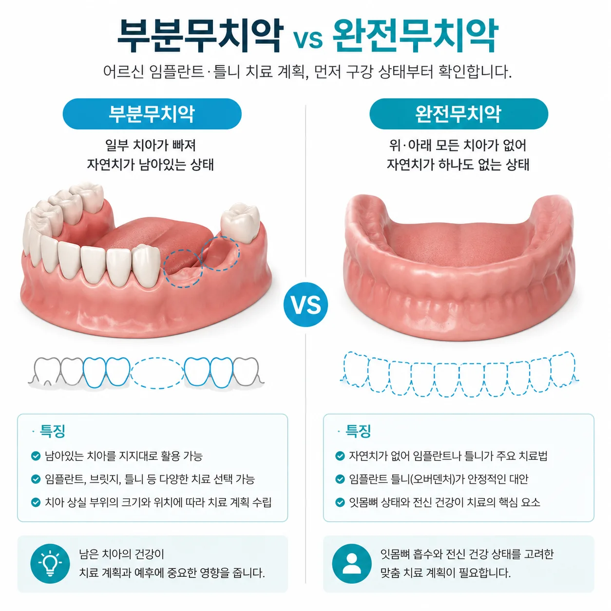 부분무치악 완전무치악 차이 설명 일러스트