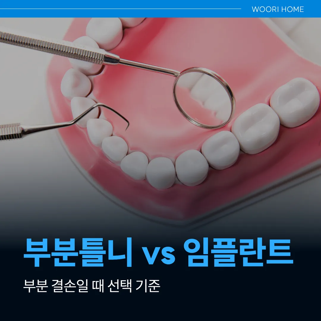 부분틀니 vs 임플란트, 부분 결손일 때 선택 기준 (울산 남구)