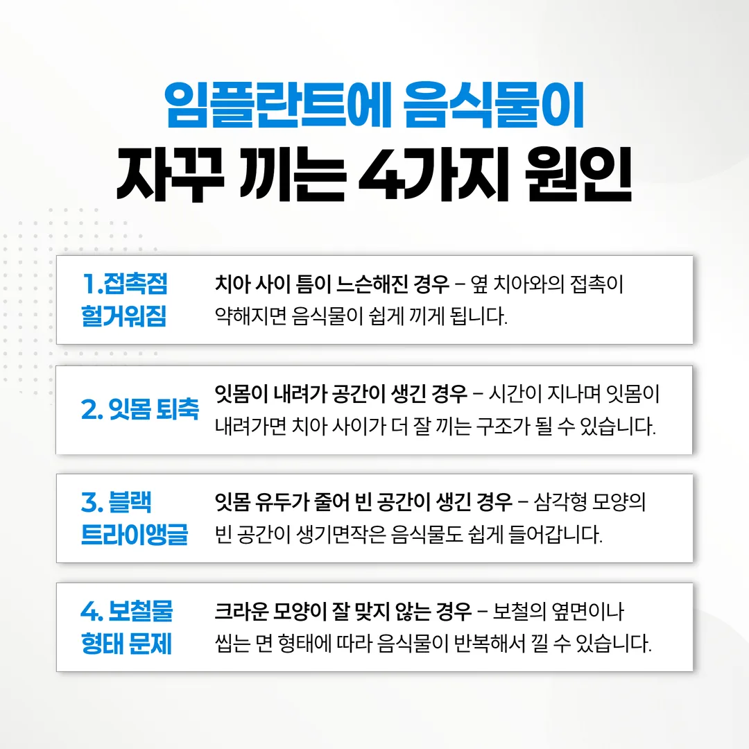 임플란트 음식물 끼임의 4가지 원인 비교 인포그래픽