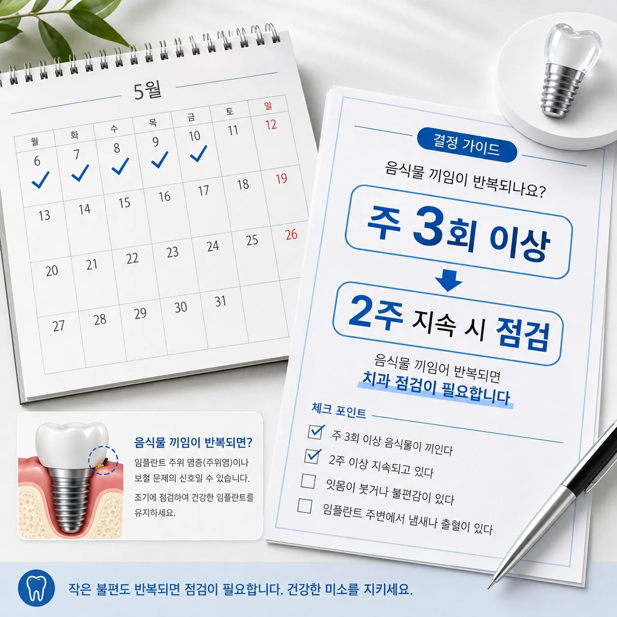 임플란트 음식물 끼임 치과 방문 기준 시간·횟수 결정 가이드