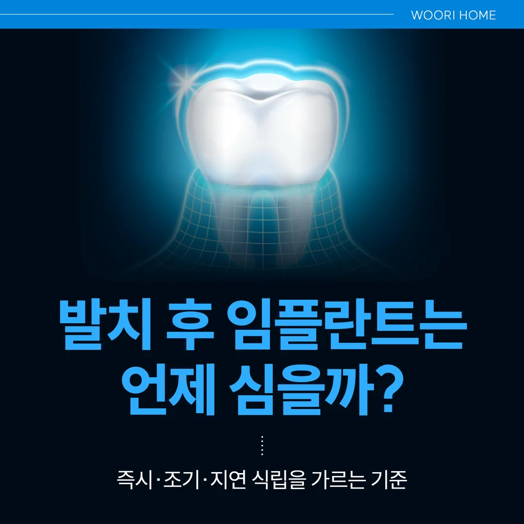 발치 후 임플란트는 언제 심을까 — 즉시·조기·지연 식립을 가르는 기준