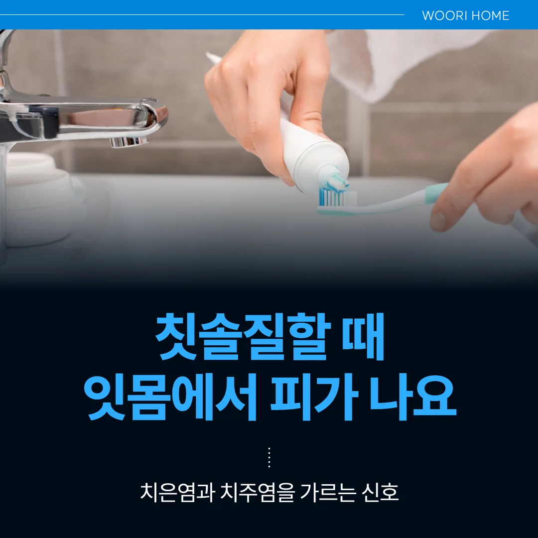 칫솔질할 때 잇몸에서 피가 나요 — 치은염과 치주염을 가르는 신호