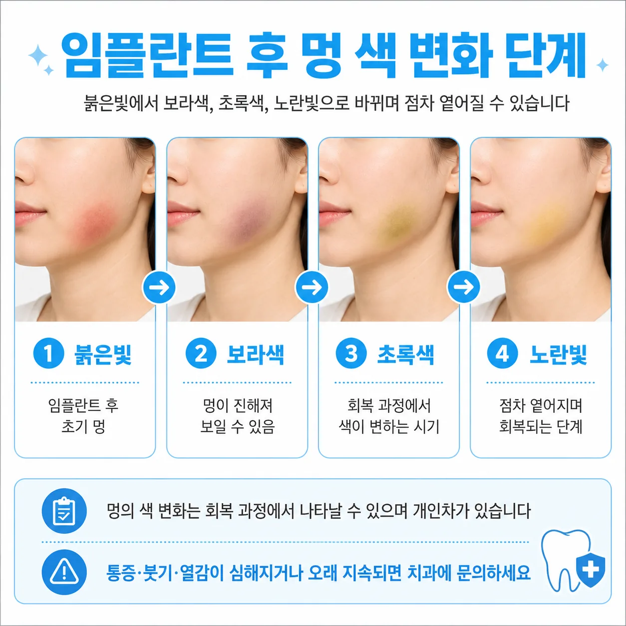 임플란트 멍 색 변화 단계