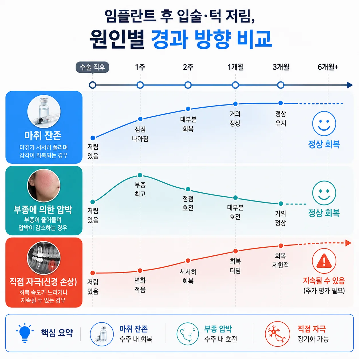 임플란트 후 감각이상 원인별 경과 방향 비교