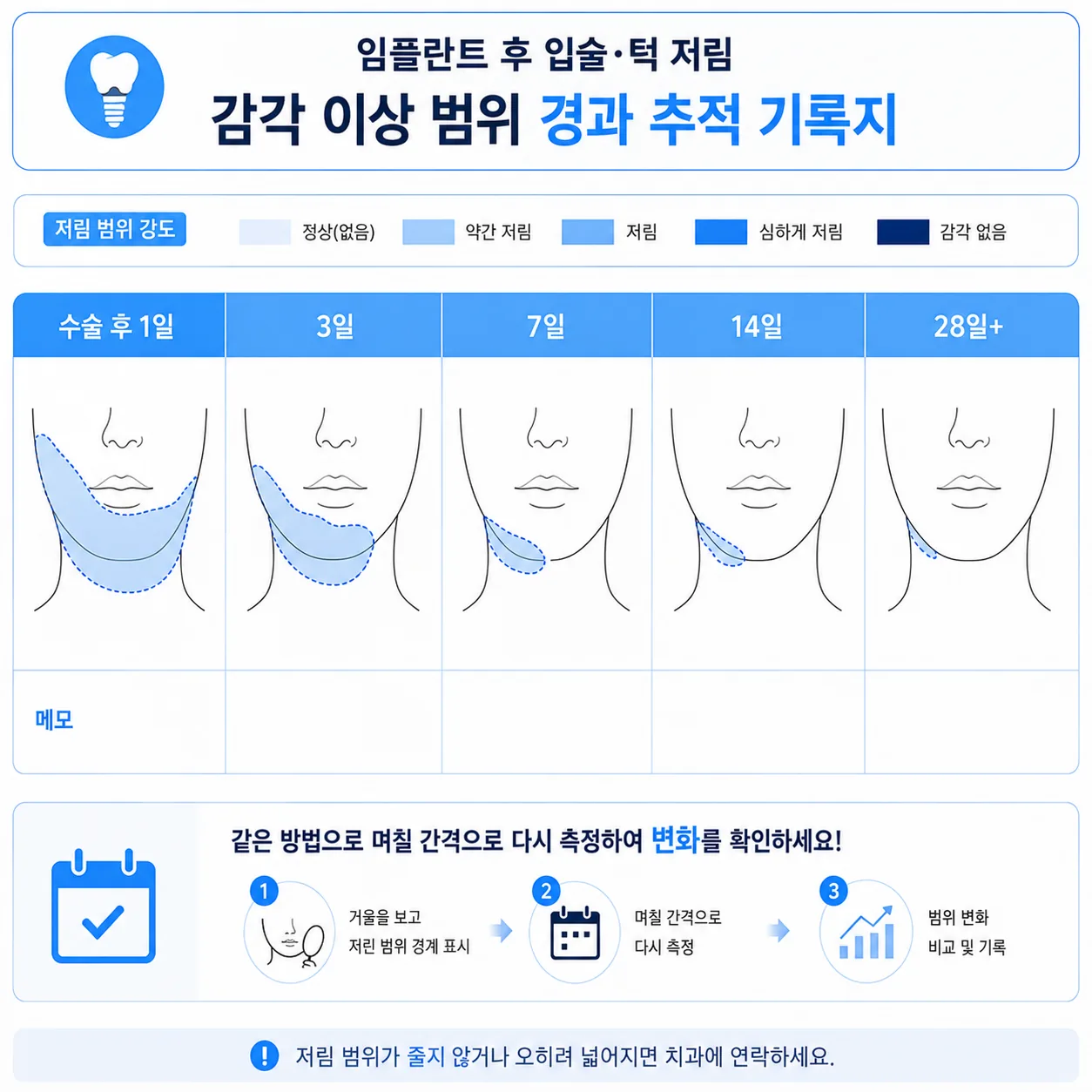 치과에서 감각 이상 범위를 기록하고 추적하는 방법