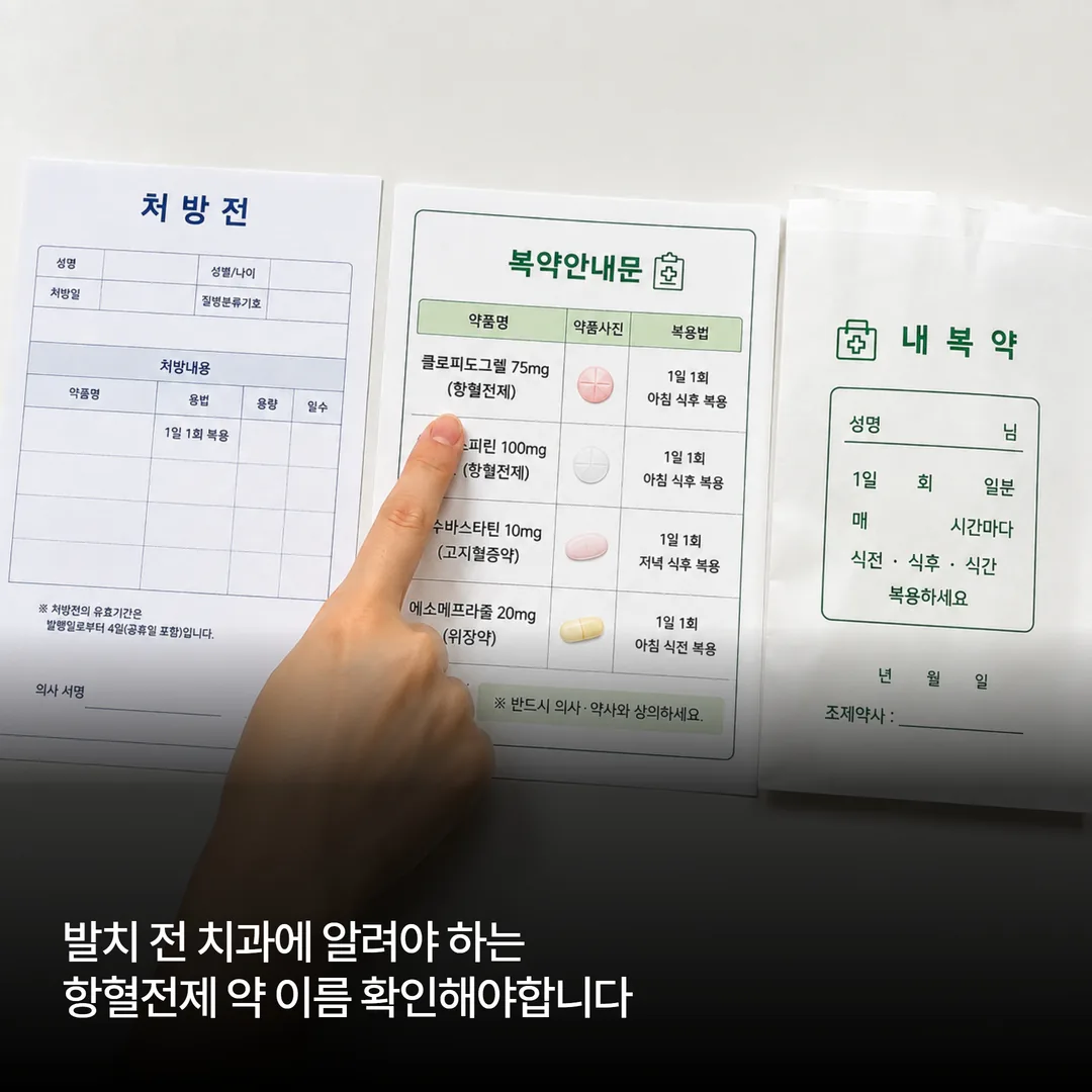 발치 전 치과에 알려야 하는 항혈전제 약 이름 확인