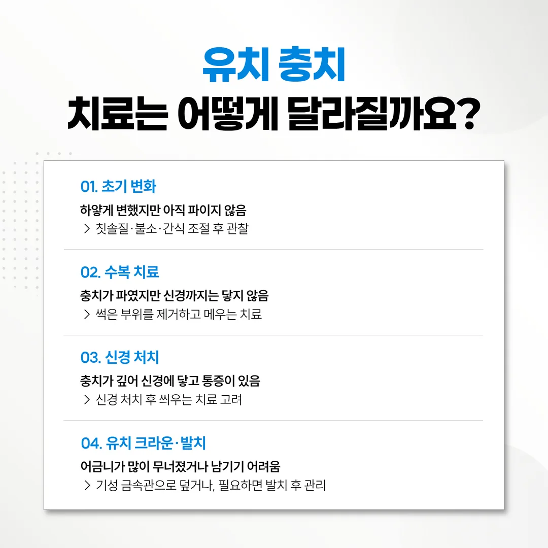 유치 충치 깊이별 치료 갈래인 수복 신경치료 유치 크라운 흐름도