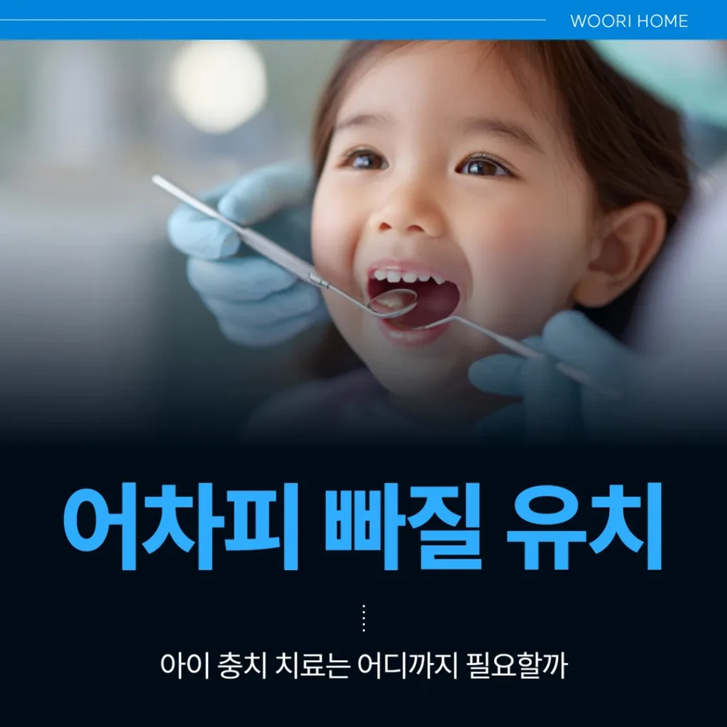 어차피 빠질 유치, 아이 충치 치료는 어디까지 필요할까