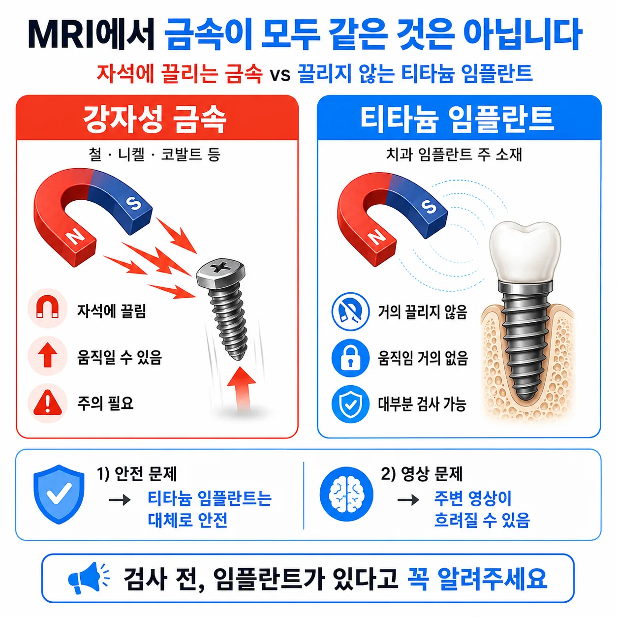 자석에 끌리는 금속과 끌리지 않는 티타늄 임플란트 비교 그림