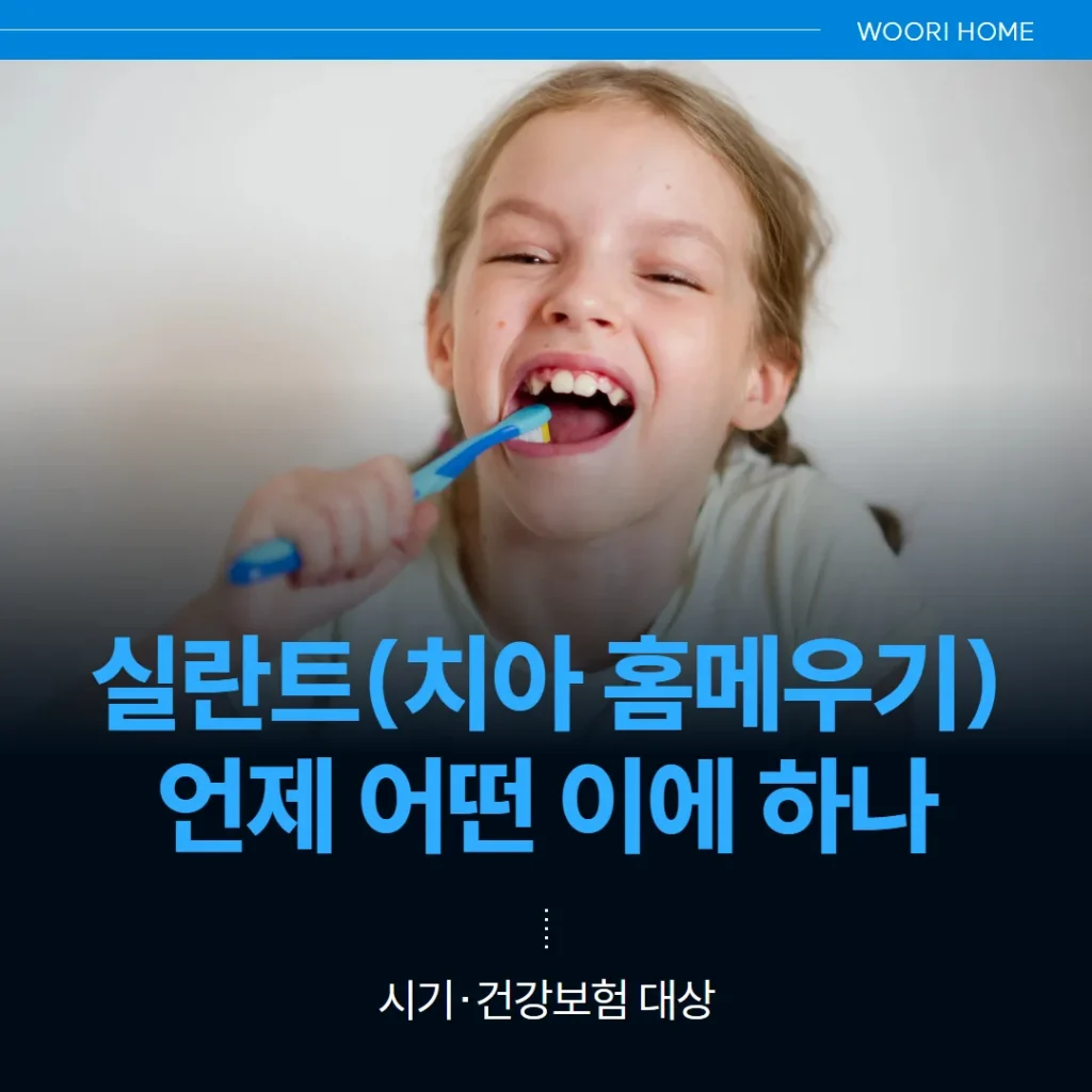 실란트(치아 홈메우기), 언제 어떤 이에 하나 — 시기·건강보험 대상