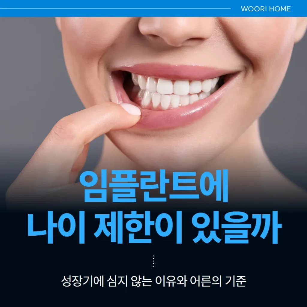 임플란트에 나이 제한이 있을까 — 성장기에 심지 않는 이유와 어른의 기준