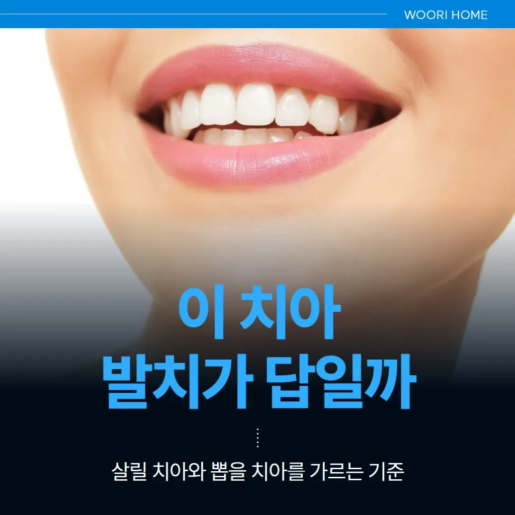 이 치아, 발치가 답일까 — 살릴 치아와 뽑을 치아를 가르는 기준