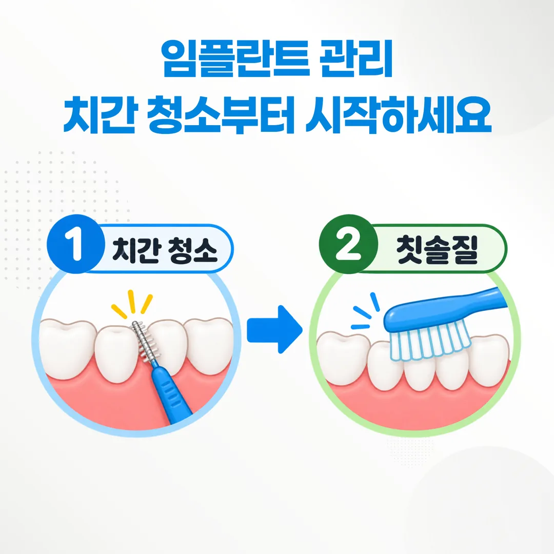 치간 청소를 먼저 하고 칫솔질을 하는 순서 흐름 그림