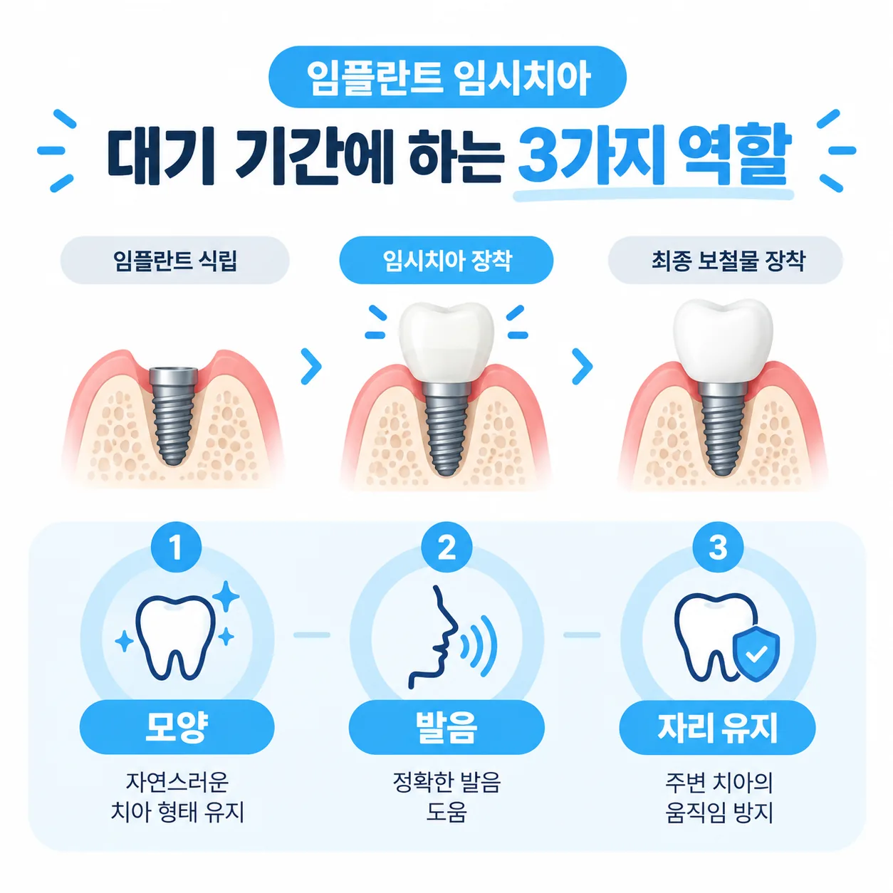 임플란트 임시치아가 대기 기간에 맡는 역할을 정리한 개념도
