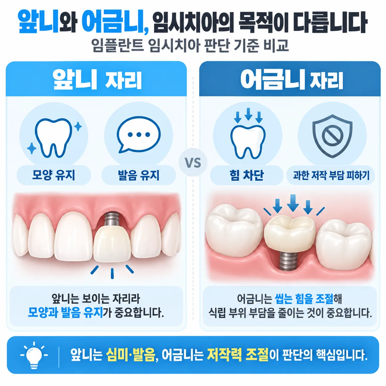 앞니와 어금니에서 임플란트 임시치아 판단이 갈리는 기준 비교 도식