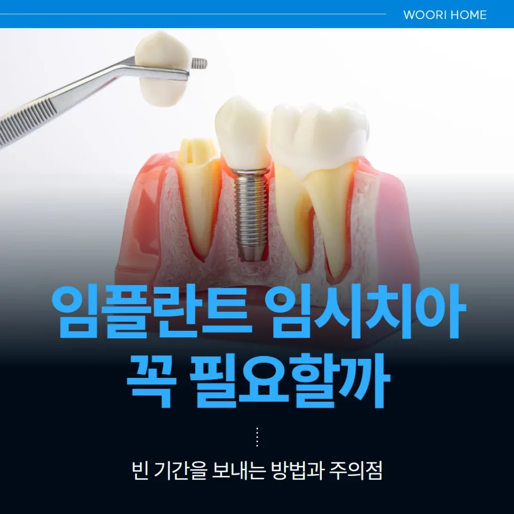 임플란트 임시치아, 꼭 필요할까 — 빈 기간을 보내는 방법과 주의점