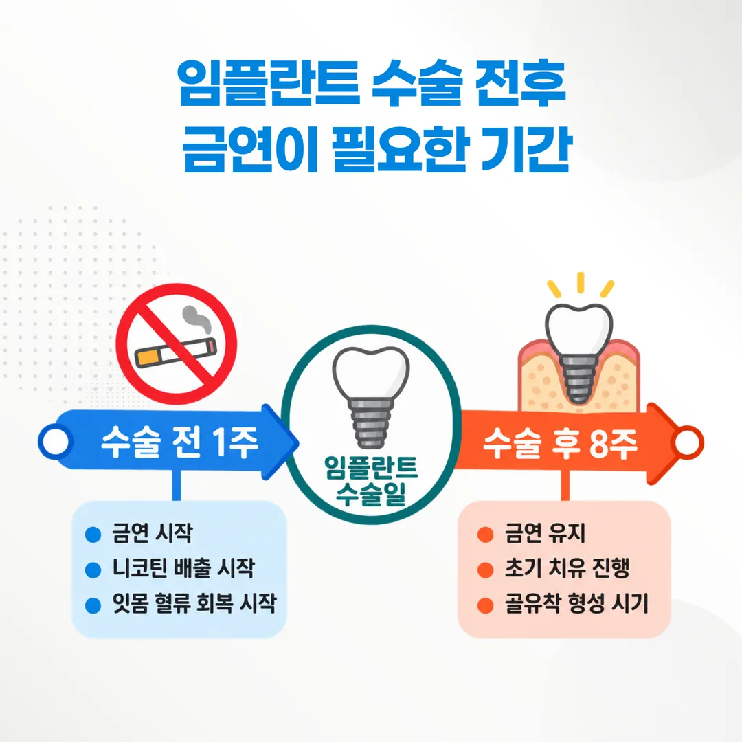 임플란트 수술 전 1주와 수술 후 8주 금연 구간을 표시한 일정표