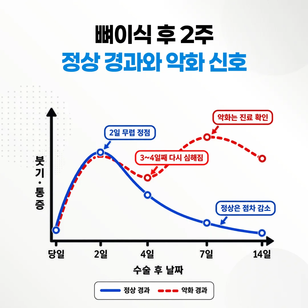 뼈이식 후 2주간 정상 경과와 방향이 바뀐 경과를 겹쳐 비교한 갈림 그래프