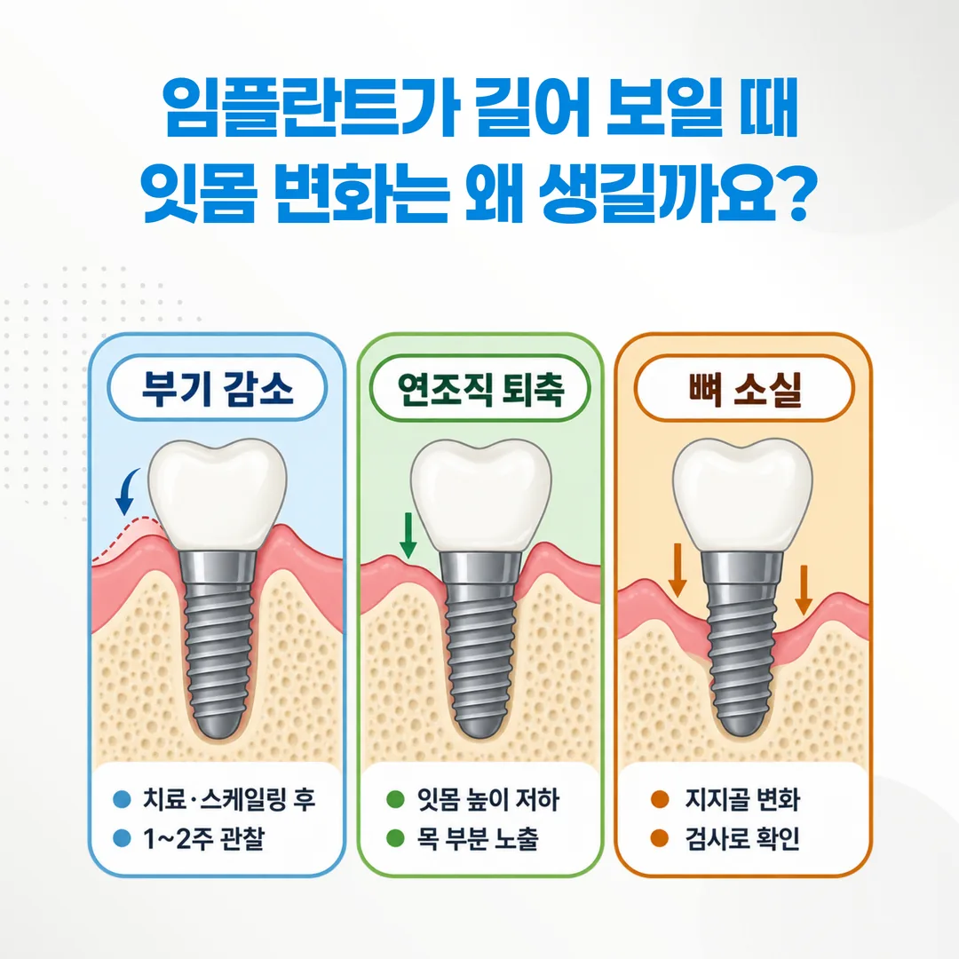 임플란트 잇몸이 내려앉아 보이는 세 가지 경우를 구분한 개념도