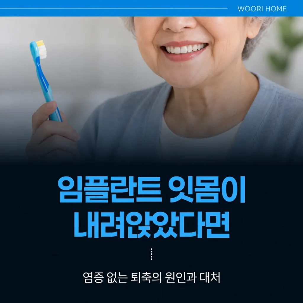 임플란트 잇몸이 내려앉았다면 — 염증 없는 퇴축의 원인과 대처