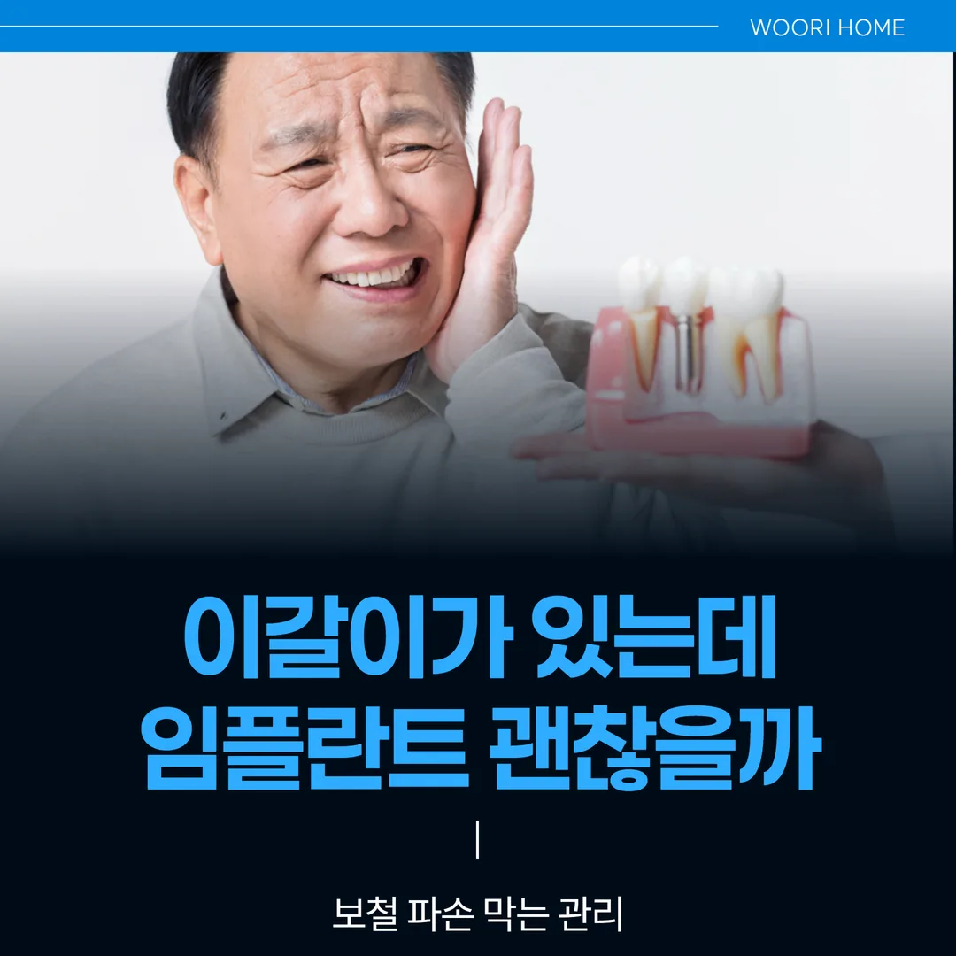 이갈이가 있는데 임플란트 괜찮을까 — 보철 파손 막는 관리