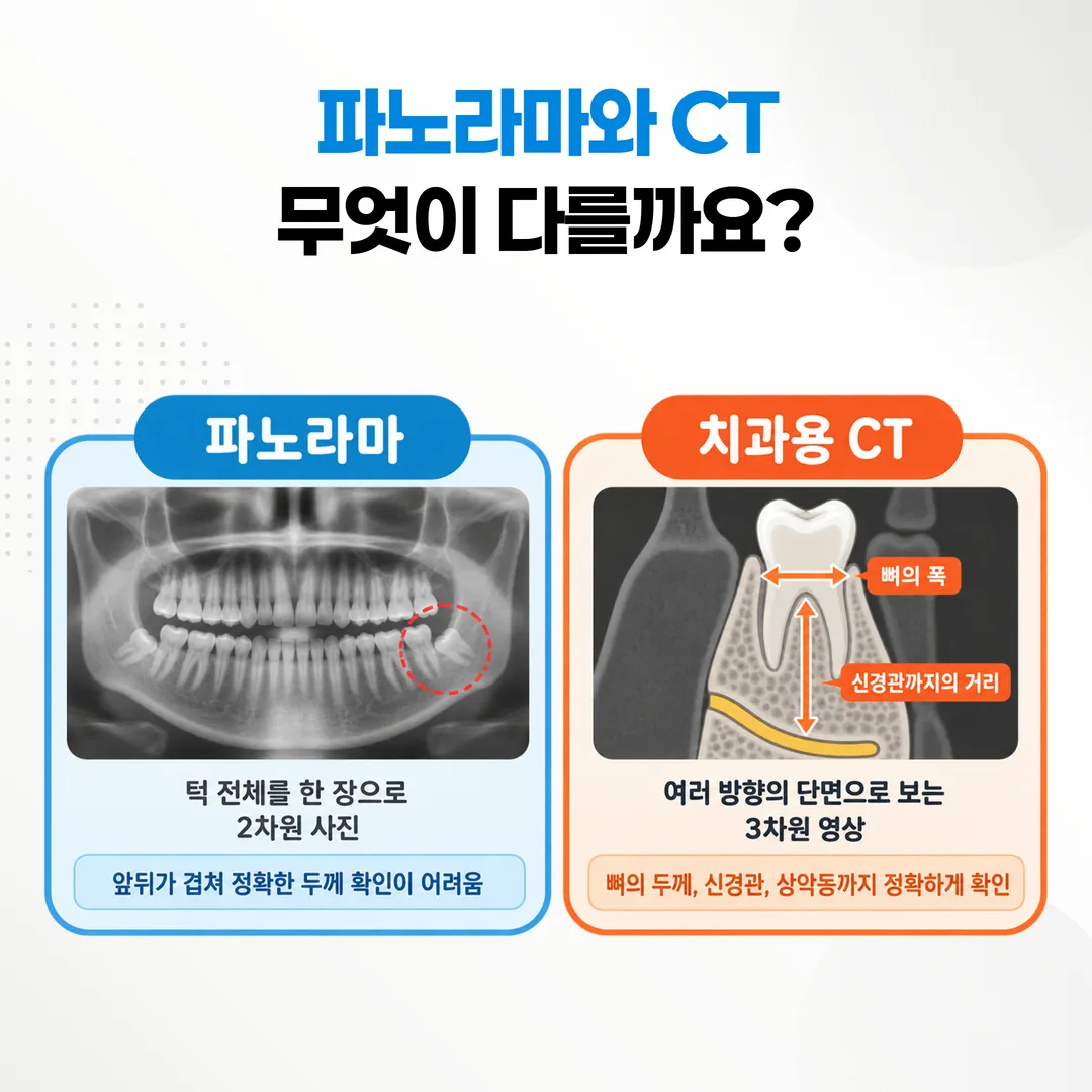 하악 어금니 단면에서 뼈의 폭과 신경관까지의 높이를 재는 지점을 표시한 도식