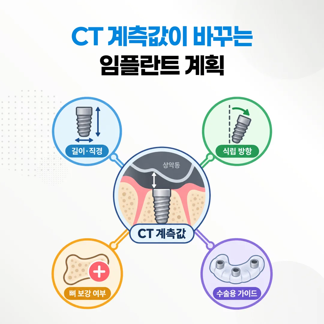 CT 계측값이 임플란트 치료 계획의 어떤 항목을 바꾸는지 보여 주는 흐름도