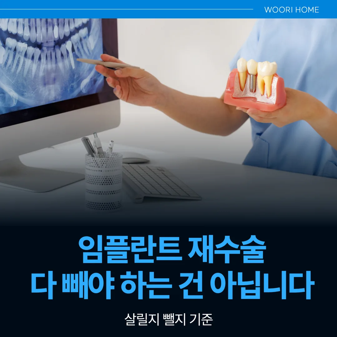 임플란트 재수술, 다 빼야 하는 건 아닙니다 — 살릴지 뺄지 기준