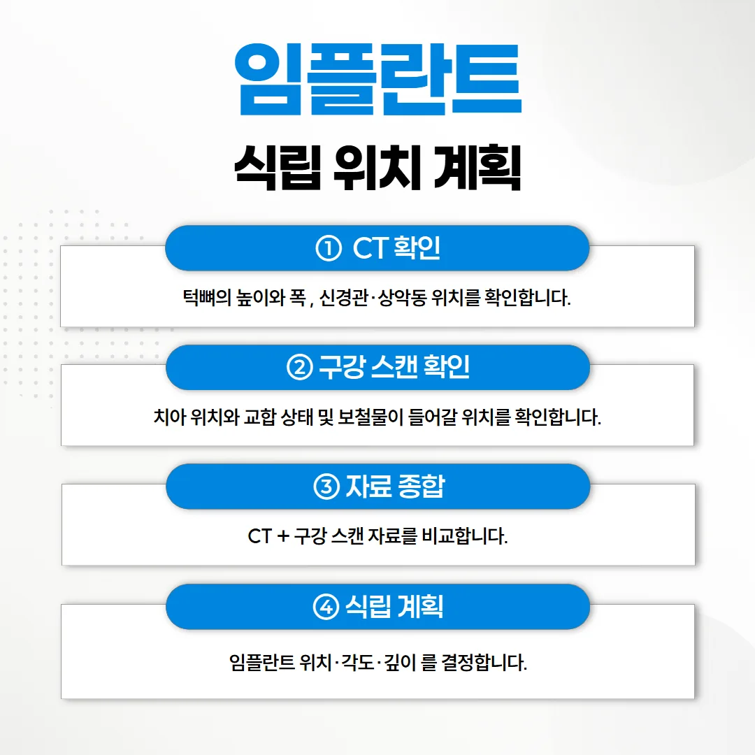 CT 자료와 구강 스캔 자료를 겹쳐 임플란트 식립 위치를 계획하는 화면