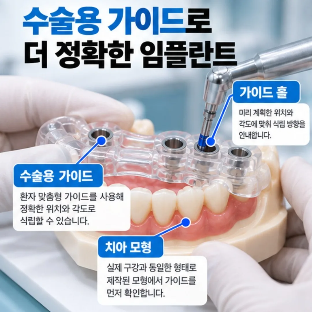임플란트 수술용 가이드를 치아 모형에 올려 방향을 확인하는 모습