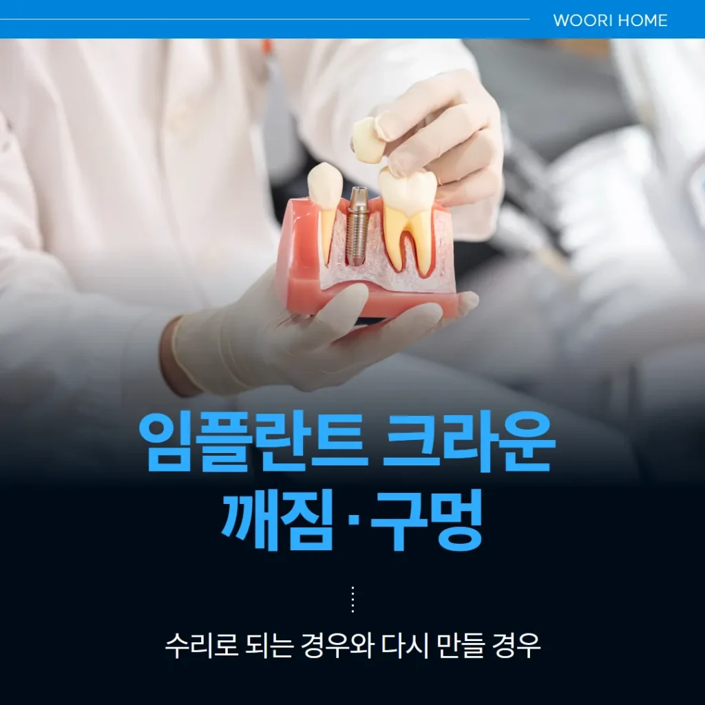임플란트 크라운 깨짐·구멍 — 수리로 되는 경우와 다시 만들 경우